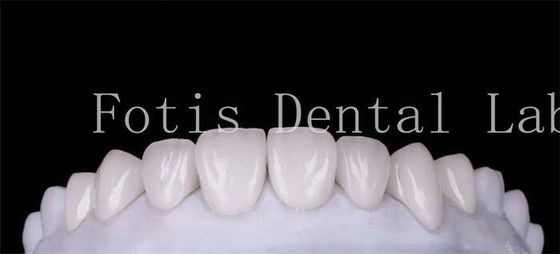 buy Polishing Finishing Cosmetic Teeth Veneer Covers  For Beautiful Smile online manufacturer