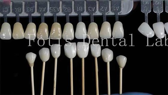 buy Customization Natural Dental Veneers Fake Teeth Overlays High Strength online manufacturer