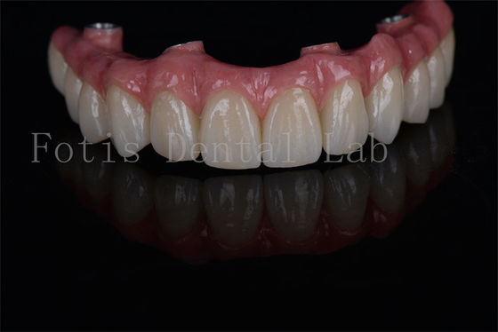buy Long Lasting All on 4 All on 6 Dental Implants Minimally Invasive Easy Maintenance online manufacturer