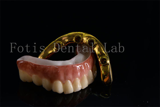 buy Affordable All On Six Dental Implants Effective Treatment Easy To Clean online manufacturer