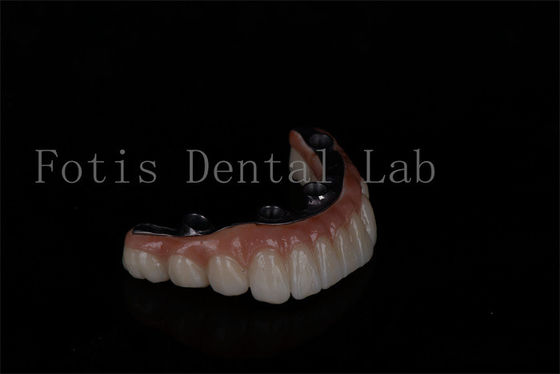 buy No Age Limit Affordable All On 6 Zirconia Implants Easy Maintenance online manufacturer