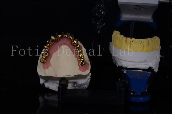 buy Affordable Titanium / Zirconia All On 4 Dental Implants For Natural Looking Smiles online manufacturer
