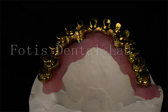 buy Natural Looking All On 4 All On 6 Dental Implants Restores Full Chewing Ability online manufacturer