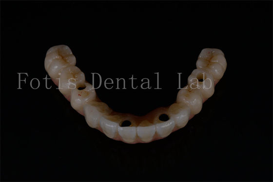 buy Replacement All On 4 All On 6 Advanced Dental Implants For Optimal Functionality online manufacturer