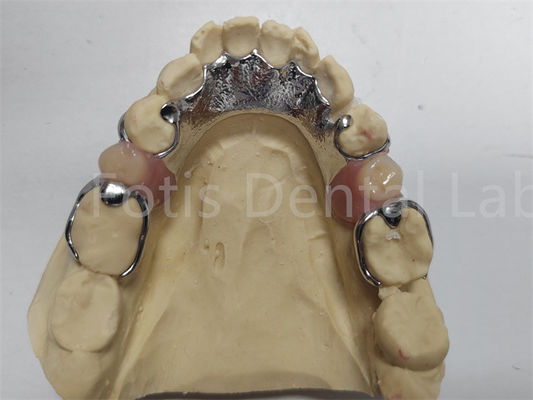 buy Adjustable Co Cr Partial Denture Comfortable Dental Prosthesis For Missing Teeth online manufacturer