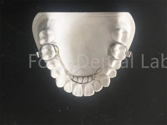 buy Customizable Expanding Retainer Palatal Expander Retainer Easy Maintenance online manufacturer