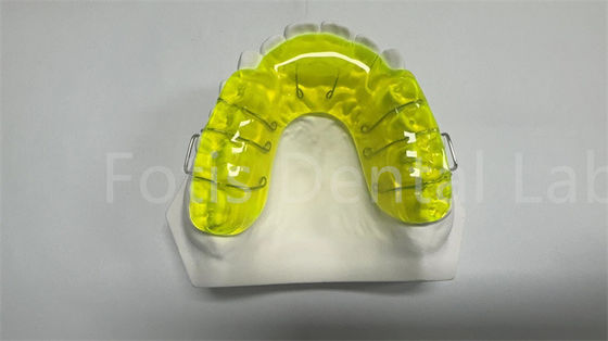 buy Safe Miechigan Retainer Expander / Orthodontic Spacer Appliance Convenient online manufacturer