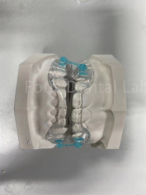 buy Professional  Comfortable Fit Retainer Expander Orthodontic Correction Device online manufacturer