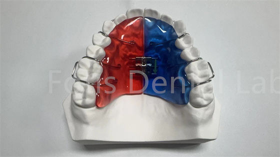 buy Individual Orthodontic Expander For Dental Correction And Improvement online manufacturer