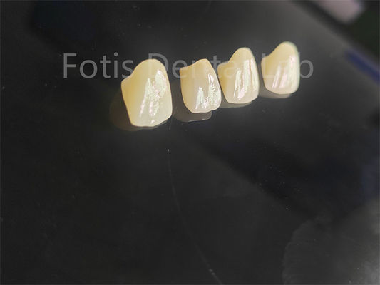buy Professional Grade Porcelain Fused Zirconia For Perfectly Fitting Dental Restorations online manufacturer