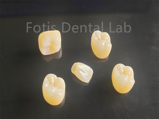 buy Aesthetic Appeal Full Porcelain Layered Zirconia Ideal For Crowns Bridges online manufacturer