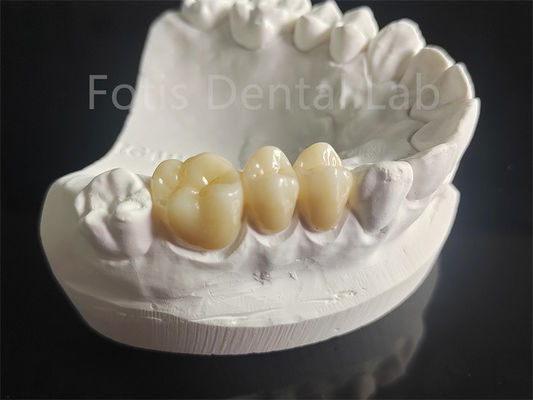 buy Wear Resistance Zirconia Layered With Porcelain Dental Material online manufacturer