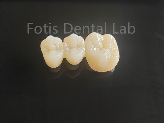 buy High Strength Porcelain Layered Zirconia For Long Lasting Dental Bridges online manufacturer