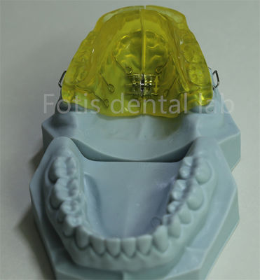 buy Customizable Orthodontic Retainer for China Dental Lab online manufacturer