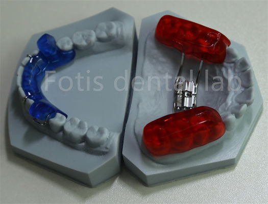 Effective Tooth Retention Dental Lab Orthodontic Space Keeper for Expanding Teeth