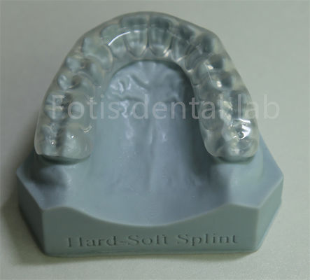 buy Adjustable And Customizable Orthodontic Retainer Expander For Teeth Retention And Expansion online manufacturer
