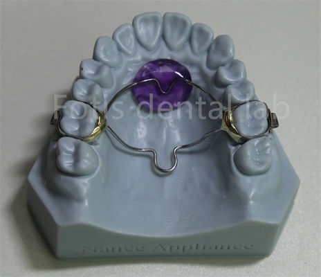 buy Dental Lab Affordable Orthodontic Expander Retainer Effective In Retaining And Expanding Teeth online manufacturer