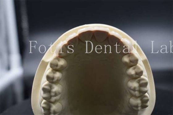 High Strength Artificial Teeth Veneers Dentist Porcelain Veneers Natural Looking