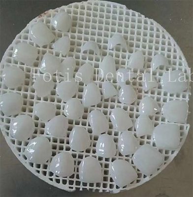 Upgrade Your Polishing Game with Smooth Surface Texture Cosmetic Teeth Covers