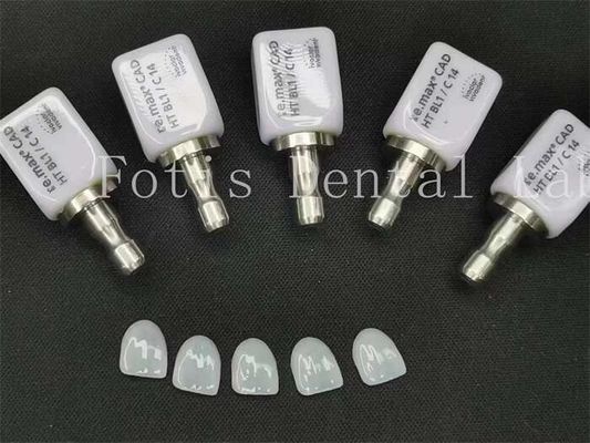 High Translucency Artificial Dental Veneers Ideal for Beautiful Cosmetic Dentistry