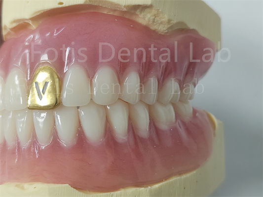 Customizable Full Denture Acrylic Teeth Odor Resistant Comfort Fit