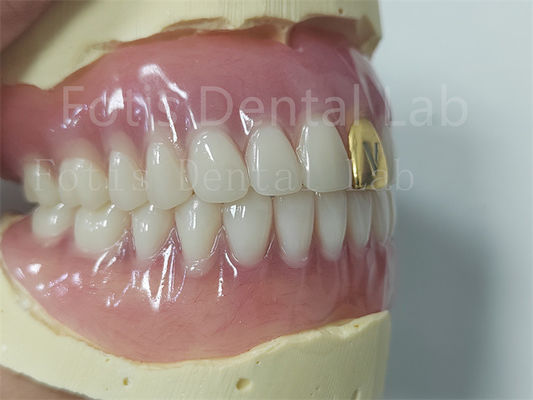 Esthetics Complete Acrylic Denture Set Customizable Fit Easy To Clean
