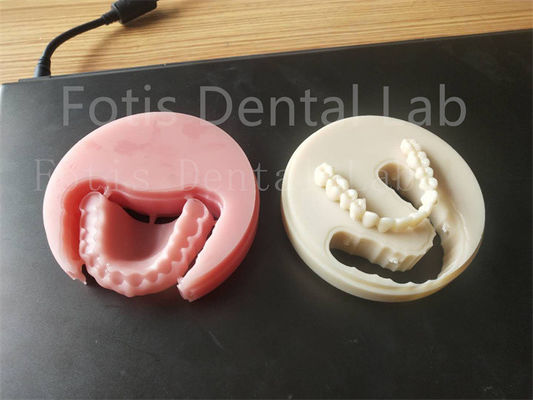 Comfort Fit Full Acrylic Dental Prosthesis For Professional Technicians Easy To Clean