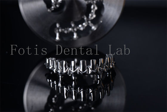 Convenient Easy To Clean All On 4 And All On 6 Implants  Professional