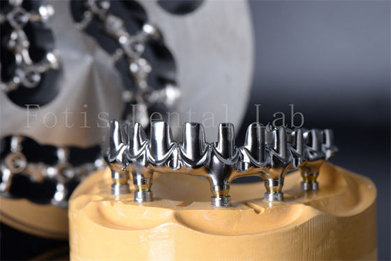 Minimally Invasive Restore Chewing All On 4 All On 6 Titanium Or Zirconia Teeth