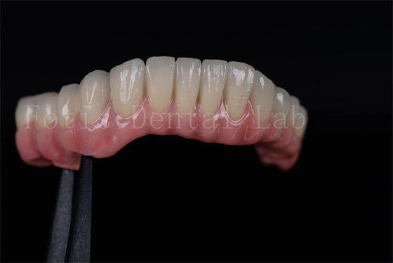 High Success Rate All On Four All On Six  Zirconia Titanium Dental Implants Customized