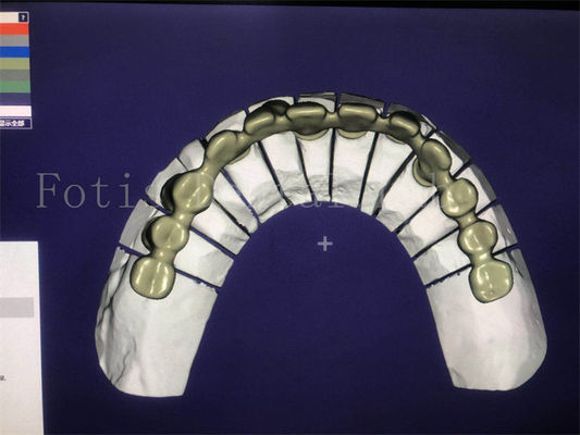 Reliable Effective Dental Design Service Superior And Competitive