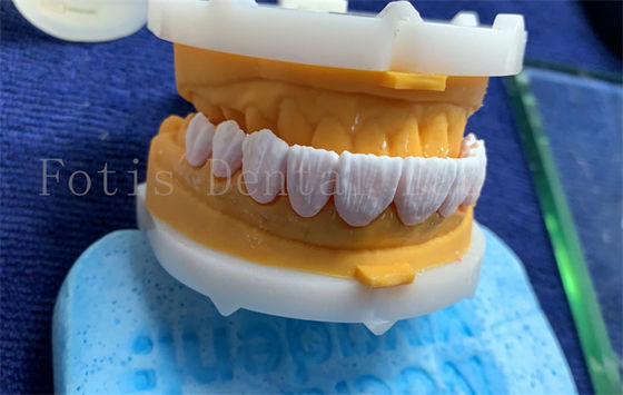 Advanced Digital Dental Crowns Implant Dentrue Crown FDA/ISO/CE Certified