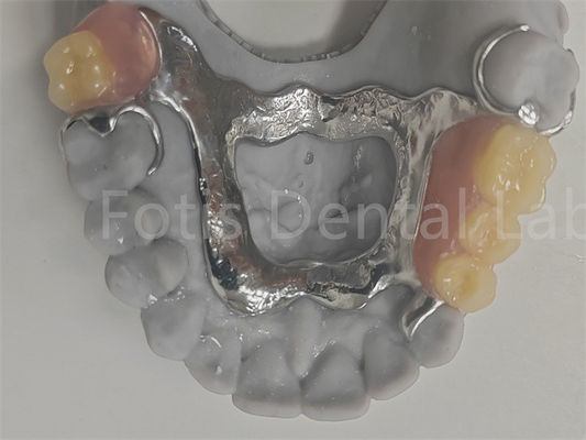 FDA Easy To Clean Removable Partial Denture Compatible With Natural Teeth