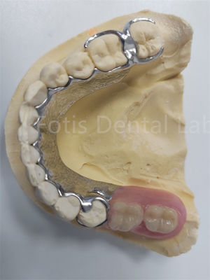 Replace Missing Teeth Removable Partial Denture Dental Prosthesis Flexible Design