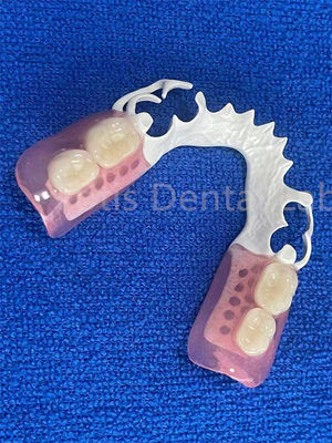 Adjustable Flexible Dental Prosthesis Stable Comfortable Immediate Partial Denture