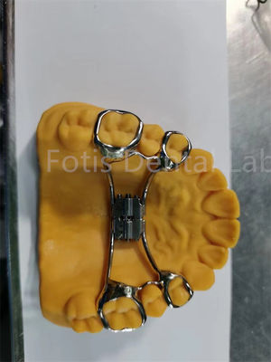 Hygienic Orthodontic Expander Easy To Clean Dental Teeth Retainer Adjustable Design