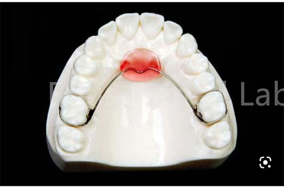 Adjustable Mouth Expanding Retainer For Safe Teeth Retention And Expansion