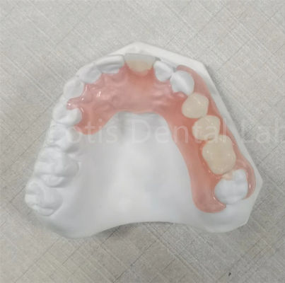 Pink / Transparent TCS Valplast Odor Resistant Flexible Dental Prosthesis