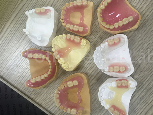Flexible TCS Valplast Removable Partial Denture Easy To Adjust