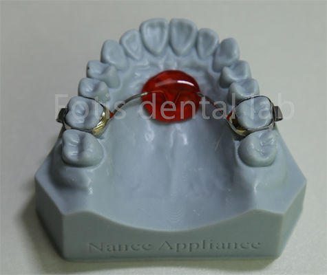 Dental Lab Orthodontic Palatal Expander Affordable and Compatible with Most Treatments