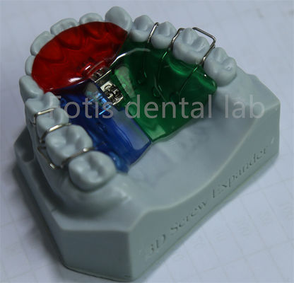 Customizable and Adjustable Orthodontic Expander for Effective Teeth Retention