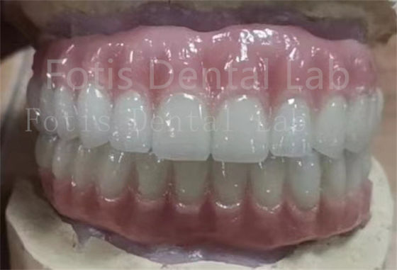 Precise Fit Ivoclar Teeth Acrylic Complete Denture Stain Resistant
