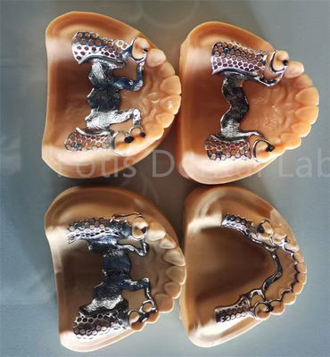 Flexible Removable Partial Denture With Long Lasting Stability And Adjustable Comfort