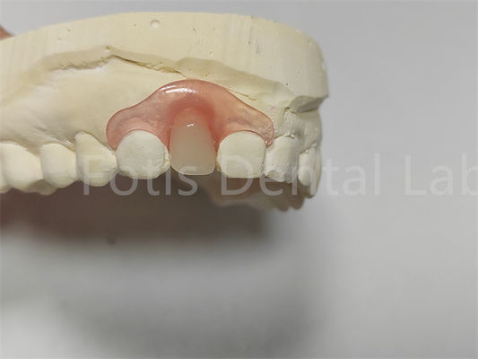 Flexible Pink / Transparent Valspar Dental Partials Easy Adjustment