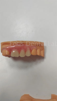 Durable TCS Flexible Partial Valplast Flexible Dentures Stain Resistant