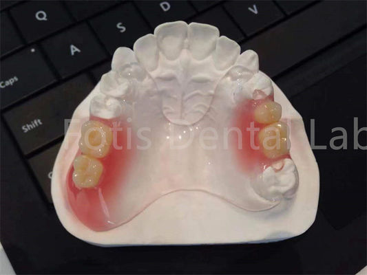 Flexible TCS Valplast Dental Appliances Comfortable Durable Design