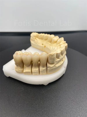 Good Performance Dental Zirconia Multilayer The Ultimate Ceramic Solution