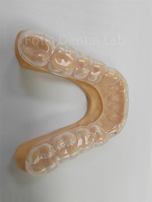 Ergonomic Hard Soft Occlusal Guard Soft Teeth Guard  Long Term Use